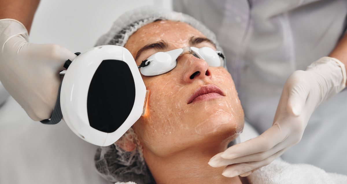 הבדל בין טיפול בפיגמנטציה כשעובדים רק עם IPL, רק עם NdYAG או משלבים ביניהם